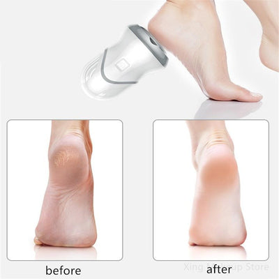 Frauen - Elektrisches Fußmassagegerät mit USB-Aufladung 